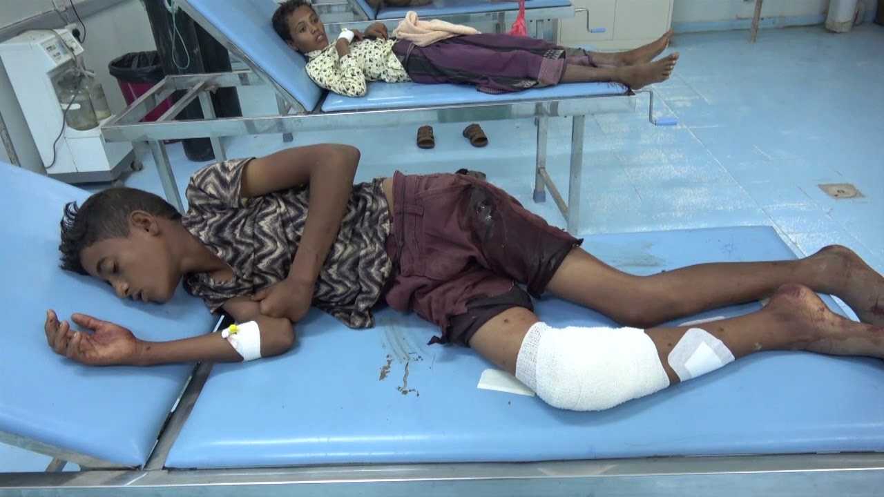 إصابة طفلين برصاص مليشيات الحوثي في مدينة حيس جنوب الحديدة